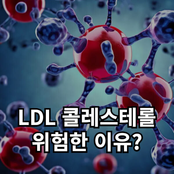 ldl 콜레스테롤 낮추는 법