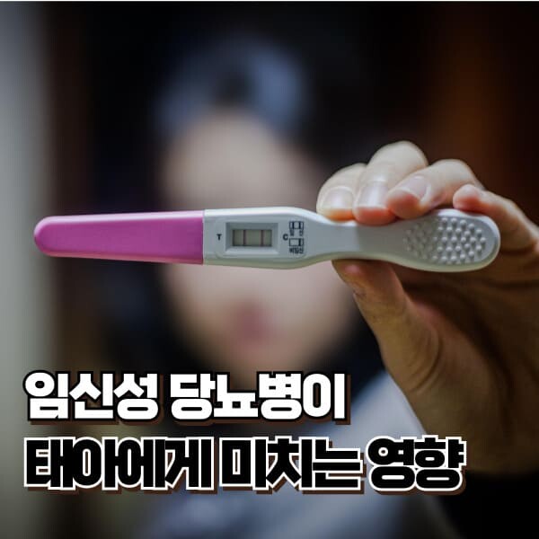 임신성 당뇨